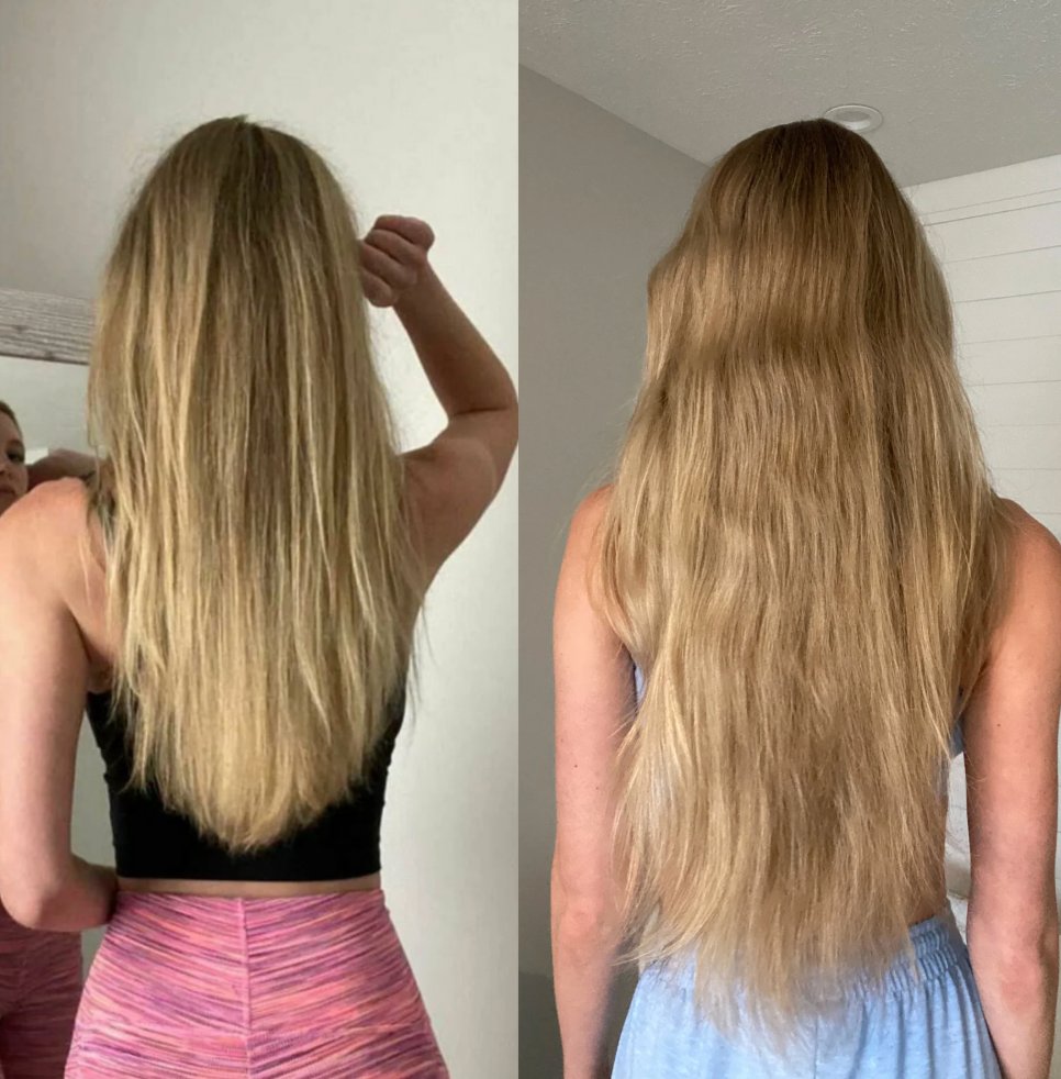 Antes e depois — crescimento capilar com WEEM