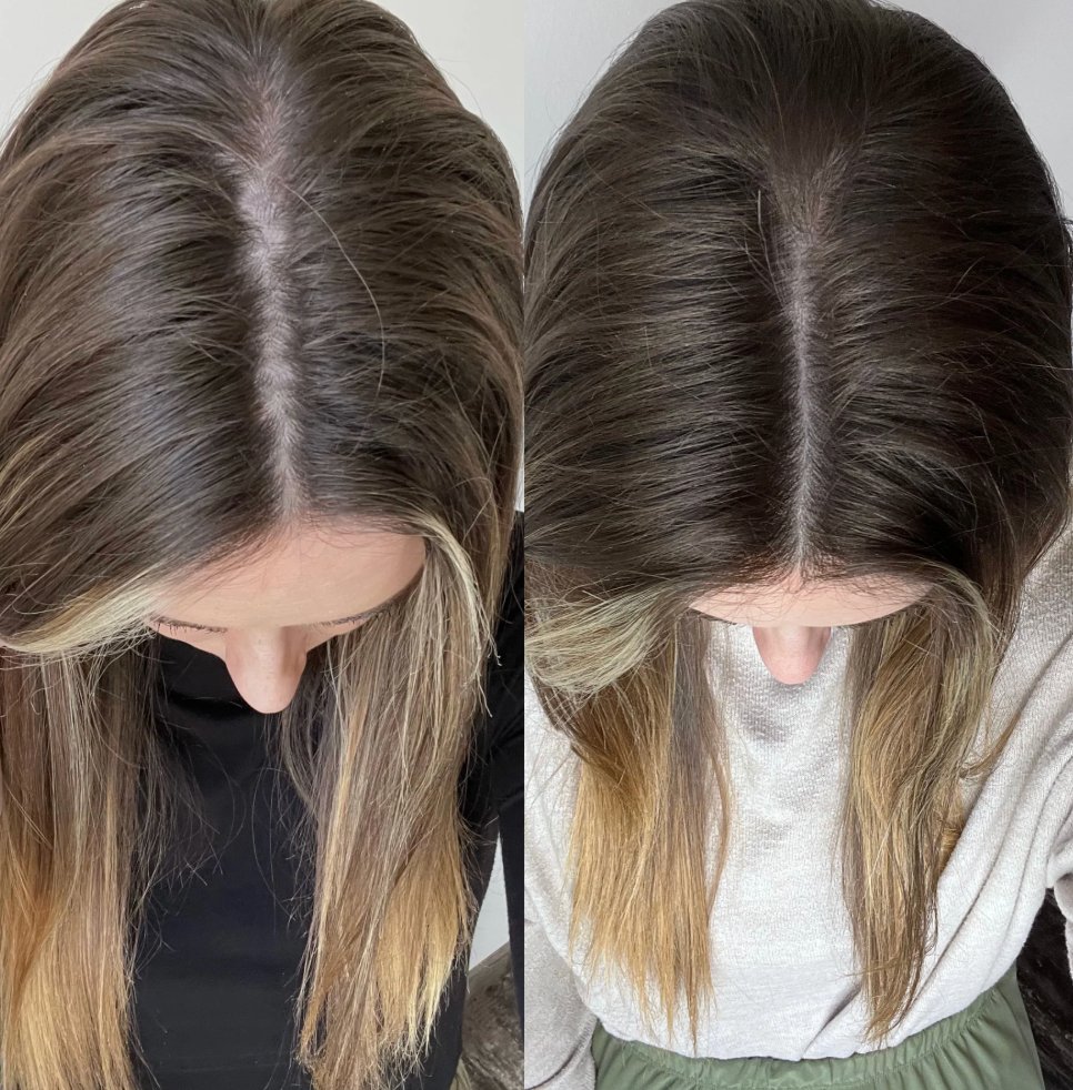 Antes e depois — saúde do couro cabeludo com WEEM